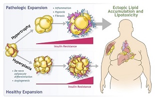 Expansion of white adipose tissue