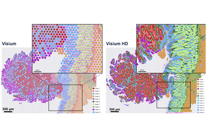 Visium vs. Visium HD Data_416x266