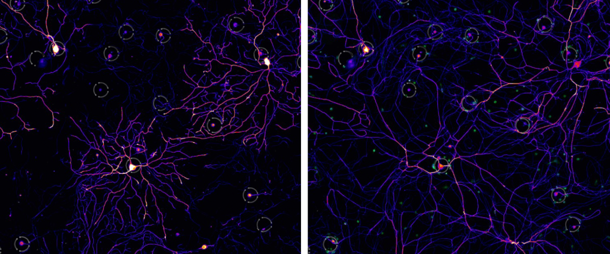MGC_Cellanome_Neuron2_header